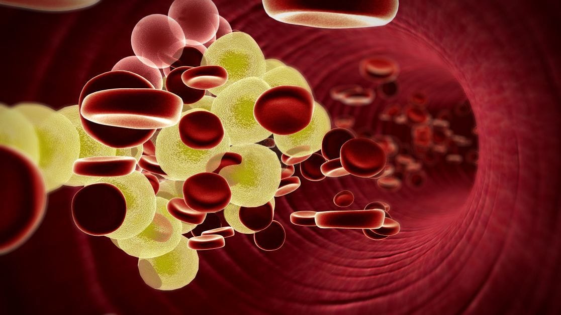 Ліпідограма у діагностиці серцево-судинних захворювань 1