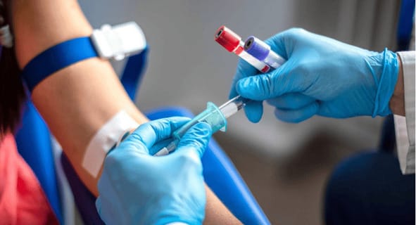 Забір крові для аналізу на триптазу — ключовий етап у діагностиці тяжких алергічних реакцій.